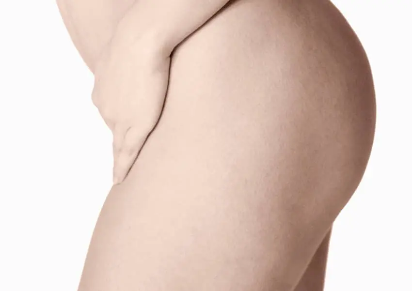 Lipoescultura.jpg Lipoescultura